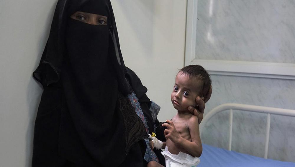 Looming famine in Yemen could put two million mothers at risk of death – UN agency