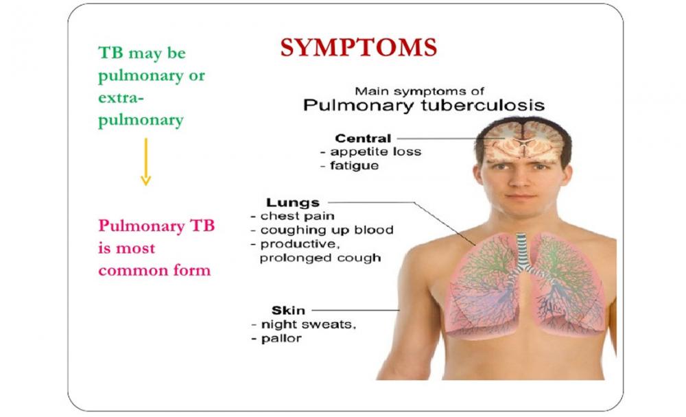 India's research efforts should focus on drug resistant TB