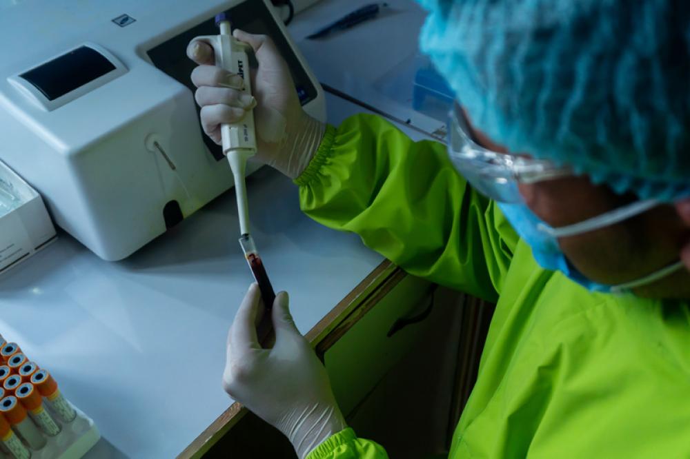Australia and India partner on COVID-19 research Australia and India partner on COVID-19 research