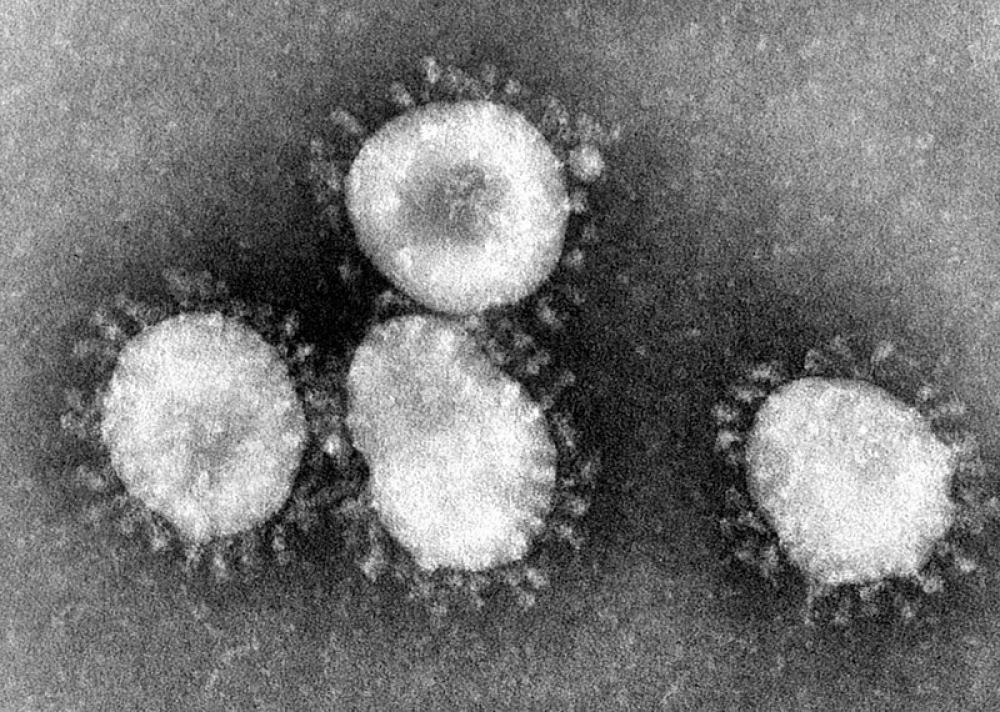 New coronavirus vaccine could take months to develop in Russia - Health Ministry Official