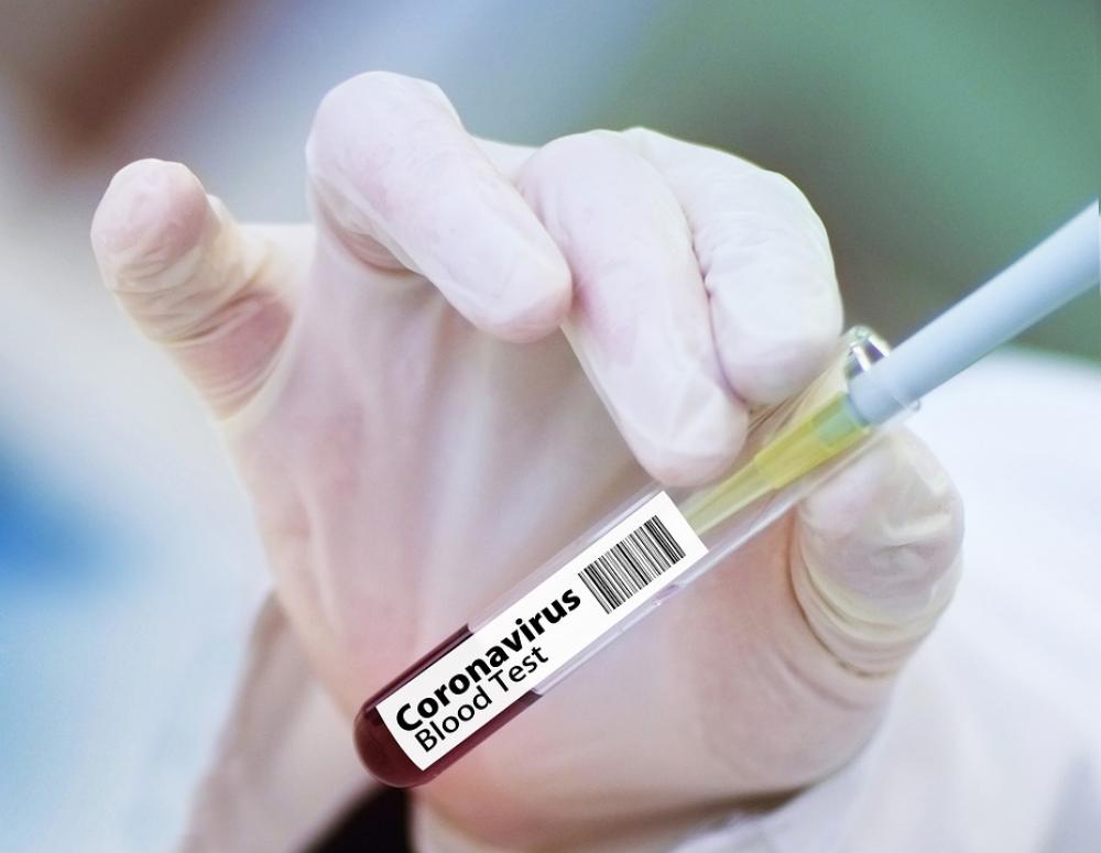 First human trial of COVID-19 vaccine finds it is safe and induces rapid immune response