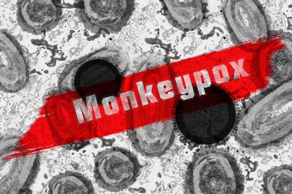 Israel reports first domestic monkeypox infection