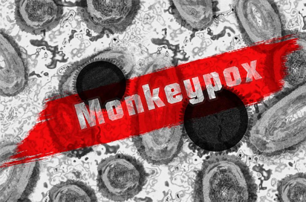 Sri Lanka reports first monkeypox case