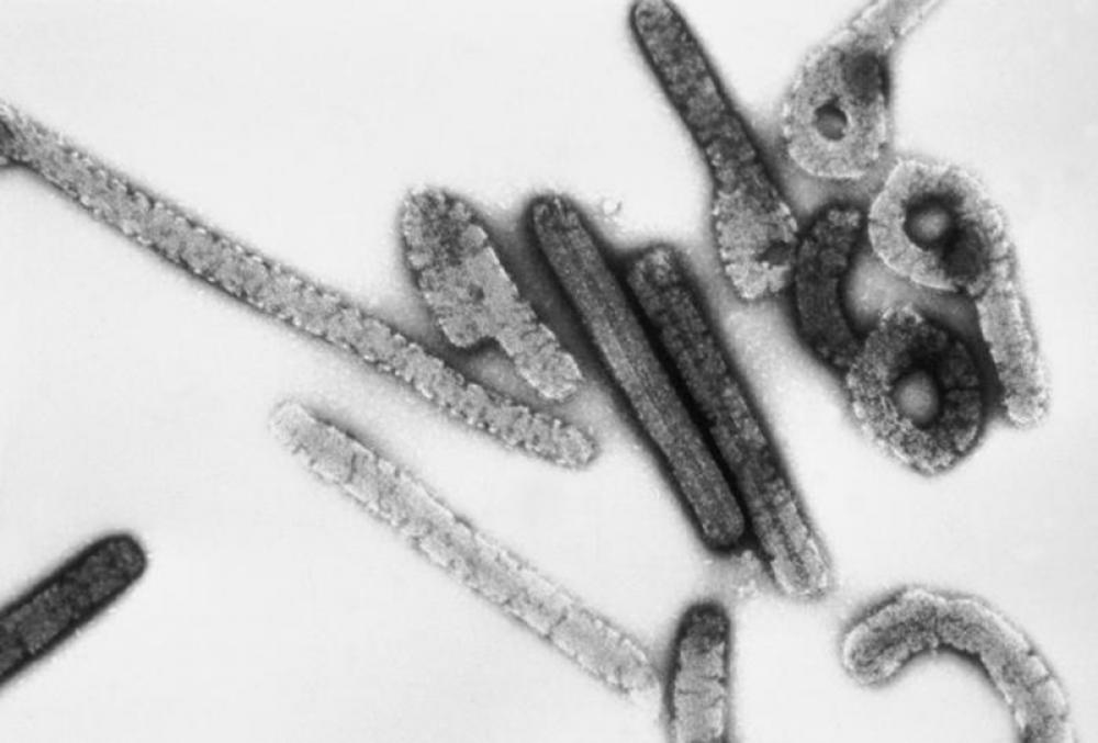 Tanzania confirms first-ever outbreak of Marburg Virus Disease