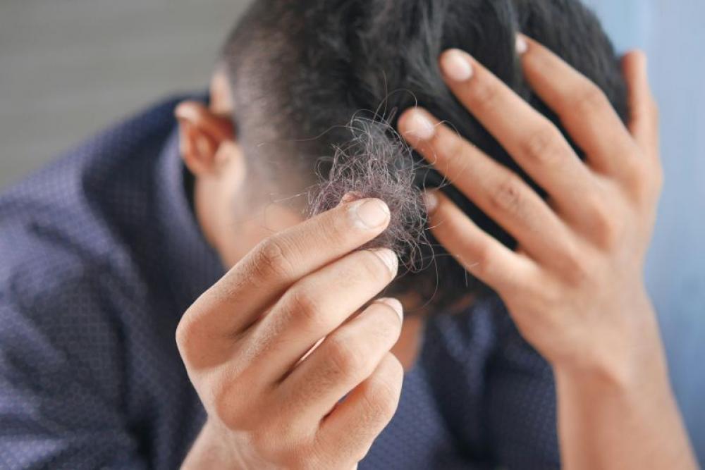 From thinning to thriving? New hair loss treatment is showing promising results in trials