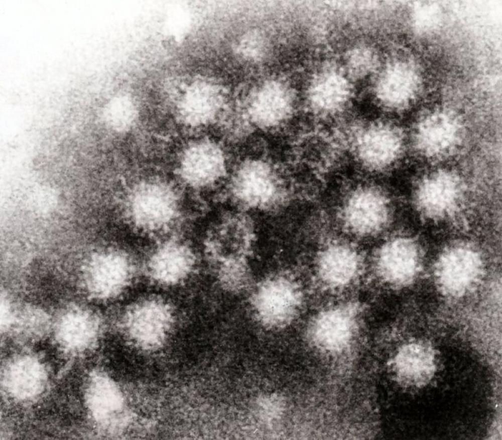 Over 100 sickened in Norovirus outbreak on Caribbean Princess cruise 