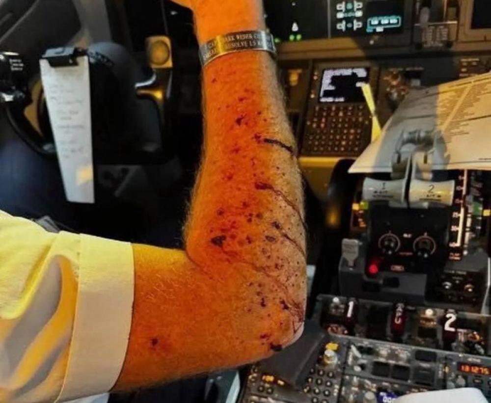 US: Boeing 737 MAX 8 windshield shatters mid-air, suffers 10,000-foot drop after an unidentified object strikes; pilot hurt US: Boeing 737 MAX 8 windshield shatters mid-air, suffers 10,000-foot drop after an unidentified object strikes; pilot hurt