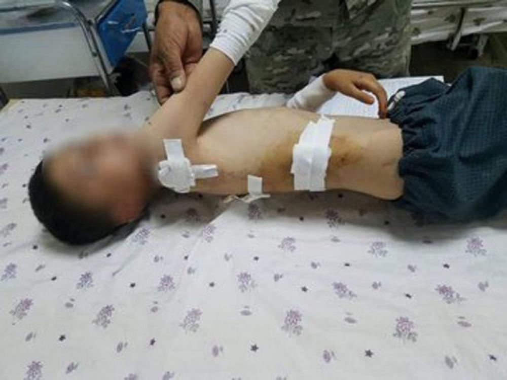 Afghanistan: Taliban terrorists fire seven mortars on Maimana City which kills 1 civilian, leaves a child hurt