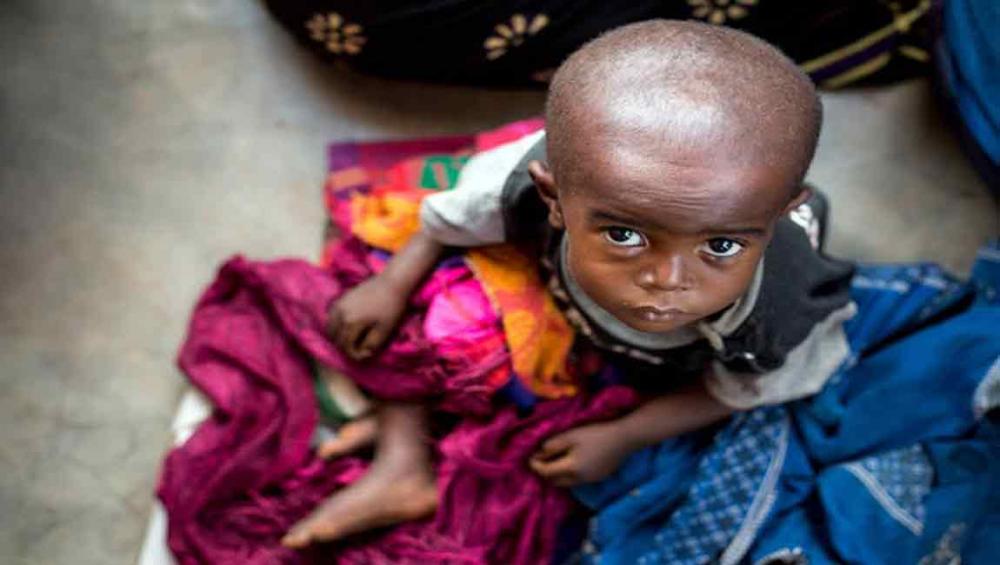 DR Congo: 400,000 children in Greater Kasai at risk of severe acute malnutrition, UNICEF warns 