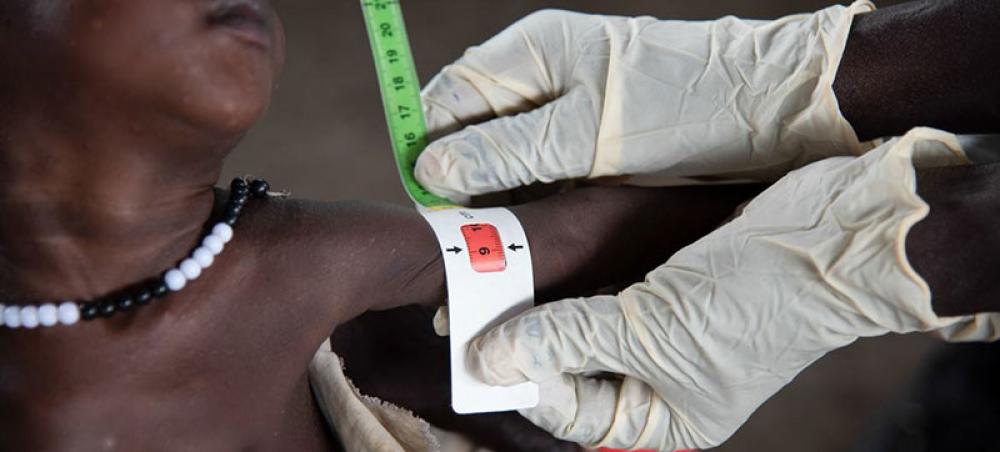 1.5 million children lack treatment for severe wasting in Eastern and Southern Africa 1.5 million children lack treatment for severe wasting in Eastern and Southern Africa